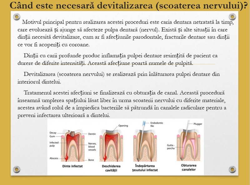 Ony Dental - cabinet stomatologic